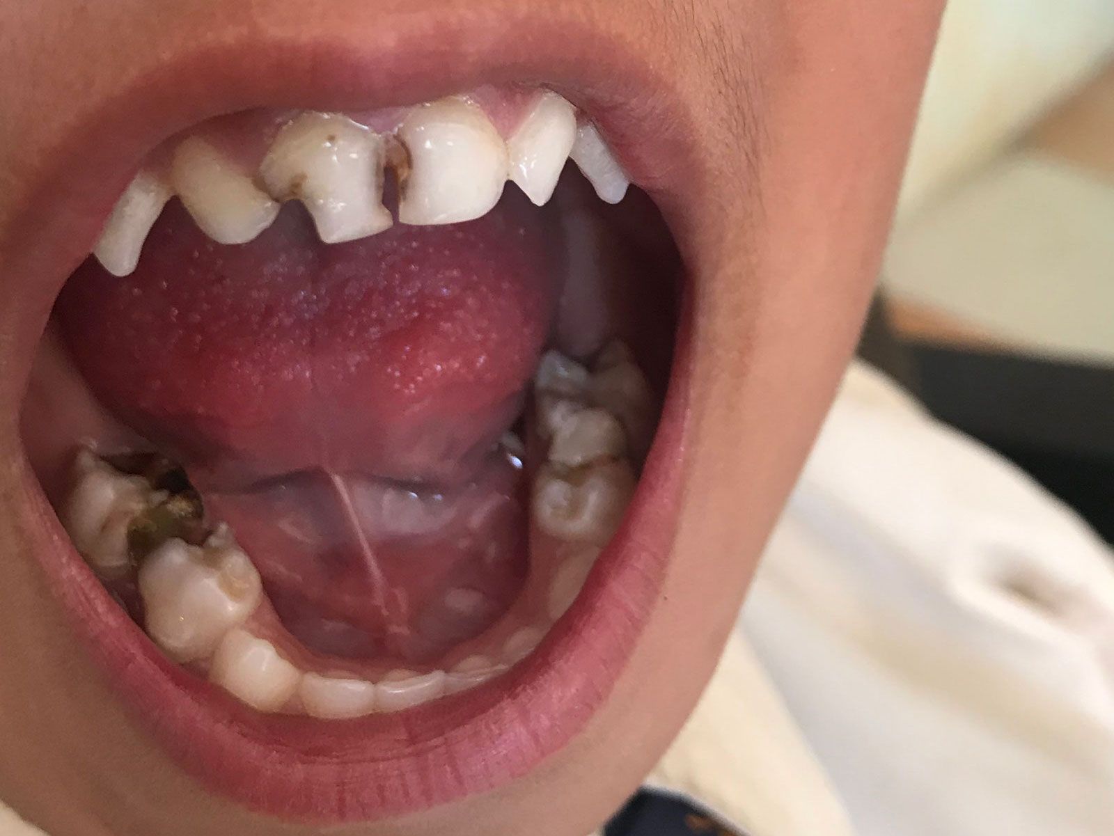 mission-trip-anchor-periodontics-4-1